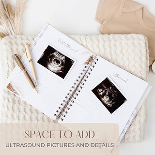 Pregnancy Journal - Baby Journal with over 200 pages Book    - Chickie Collective